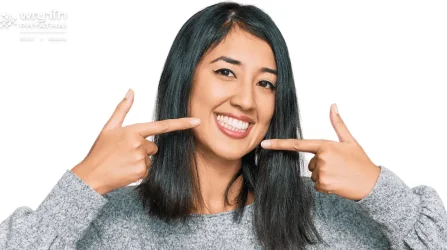 Veneers
