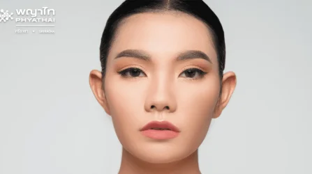 Rhinoplasty