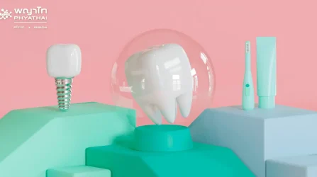 dental implant